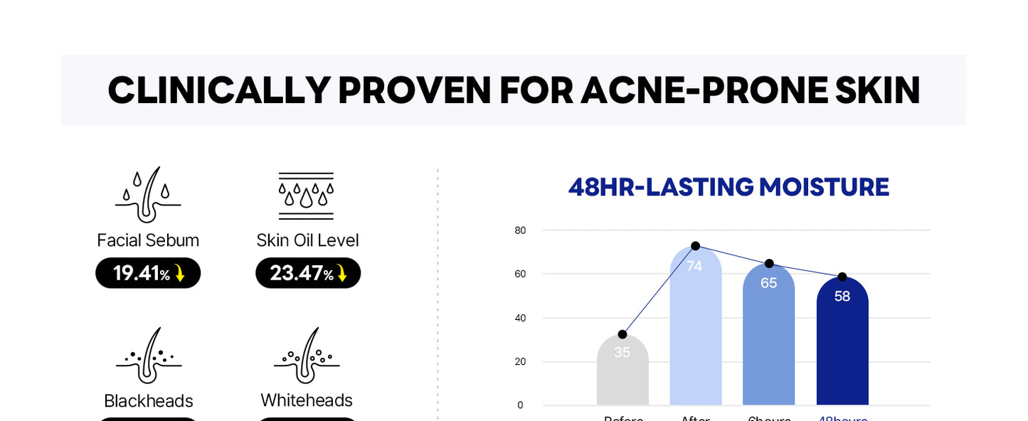 ROUND LAB Creme Hidratante de Seiva de Bétula 80 ml, Hidratante Facial Profundo de 48 Horas com Seiva de Bétula e Ácido Hialurônico Vita para Pele com Tendência a Acne, Reduz Sebo, Óleo, Cravos, Cuidados com a Pele Coreana
