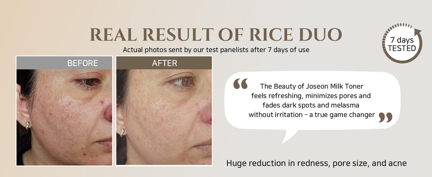 Glow Replenishing Rice Milk Tônico de Controle de Oleosidade
