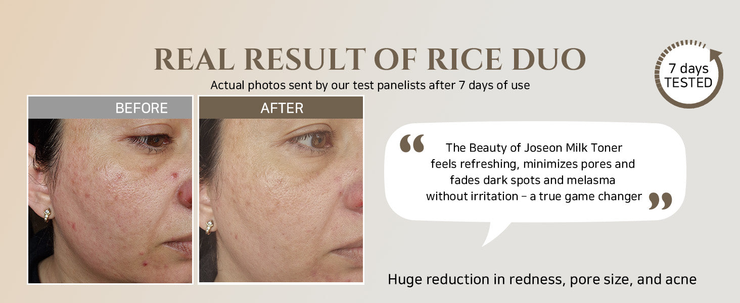 Glow Replenishing Rice Milk Sebum Toner
