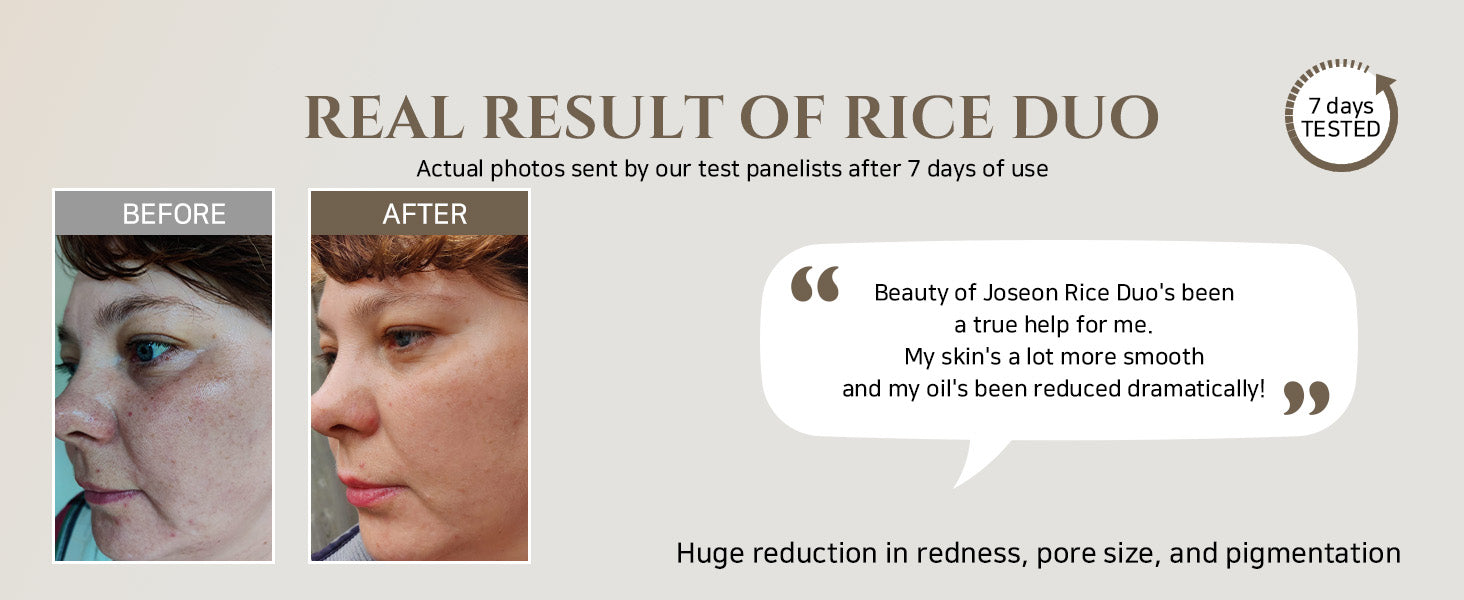 Glow Replenishing Rice Milk Toner