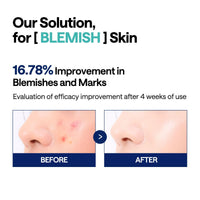 Madecassoside Blemish Pad (100 pads / 170ml)