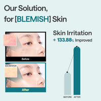Madecassoside Essential Mask (10 sheets)