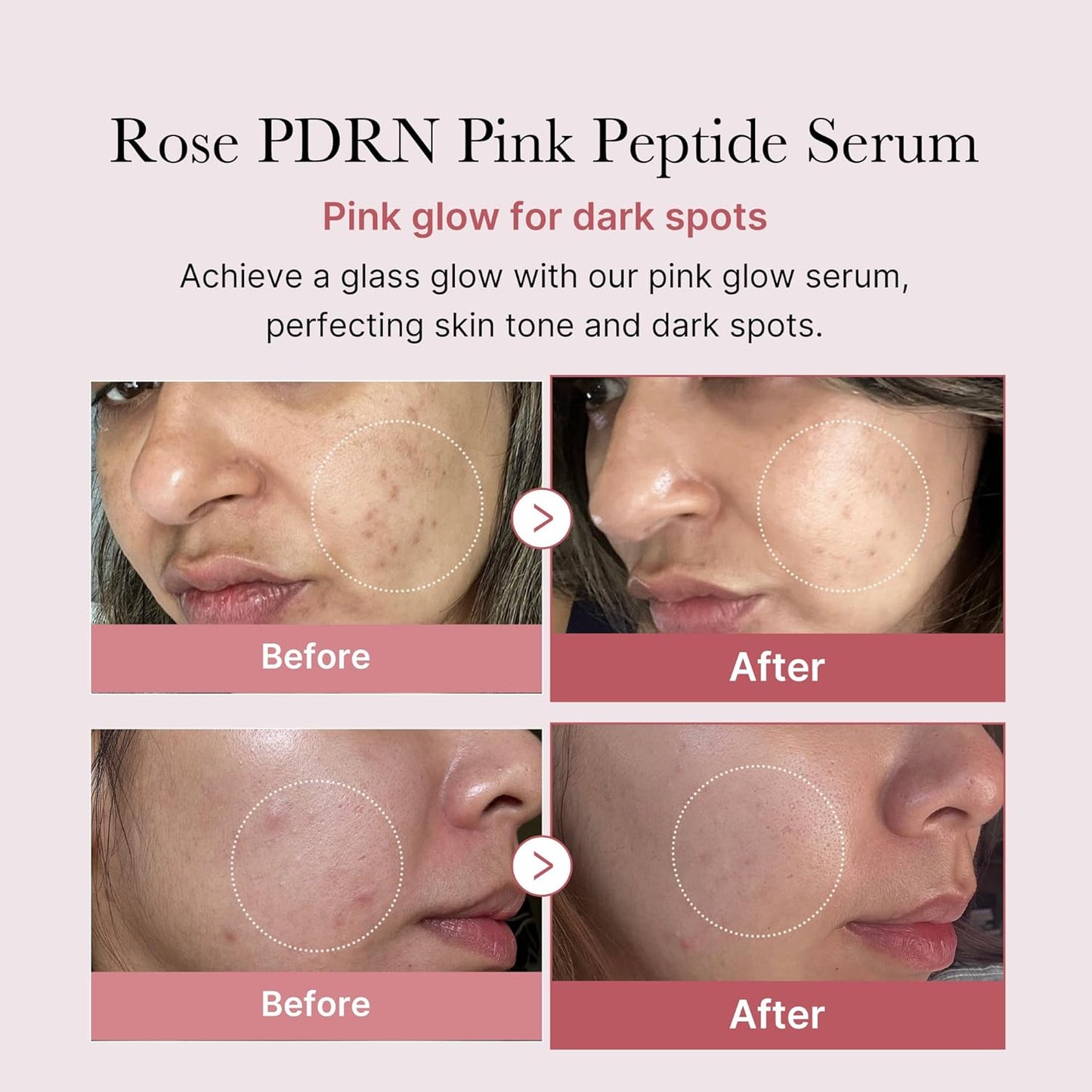 Sérum PDRN Pink Peptide
