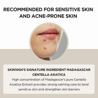 SKIN1004 Suero Facial Ampolla Centella Asiática de Madagascar 1.85 fl.oz, 55ml, Calma Piel Propensa al Acné y Sensible